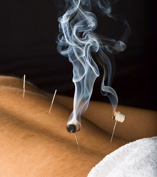 Acupuncture for Pain Relief