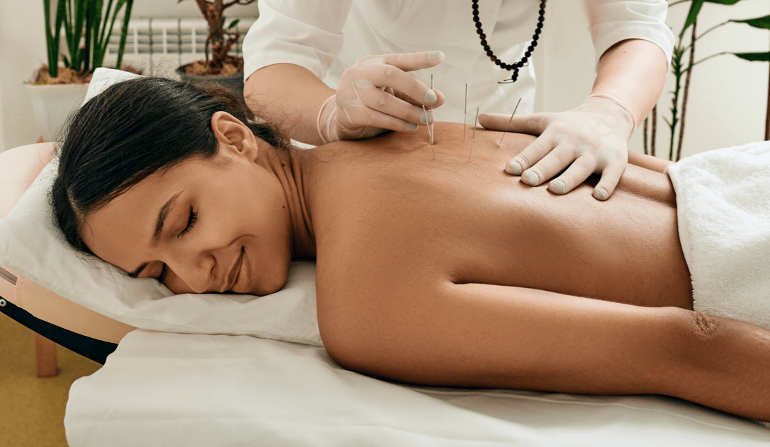 How Esoteric Acupuncture Helps You Find Your Purpose